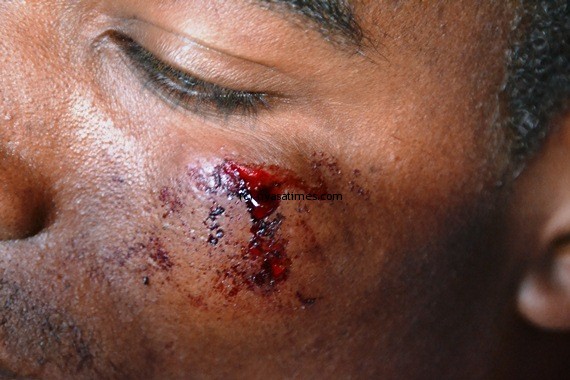 casualties2