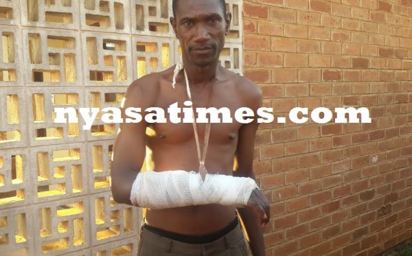 Injured by stray bullet -- Gondwe. Pic by Pius Nyondo, Nyasa Times