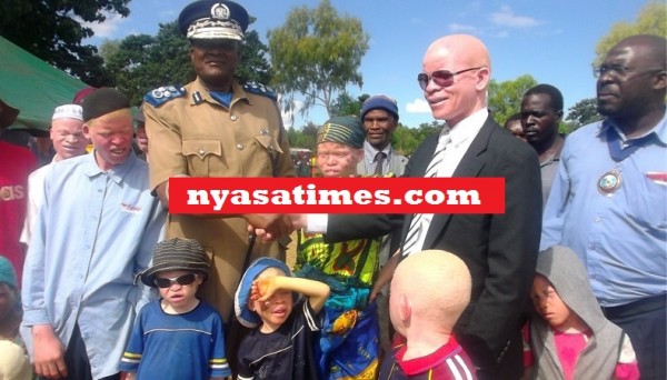 Crackdown: Kachama with other people with albinism