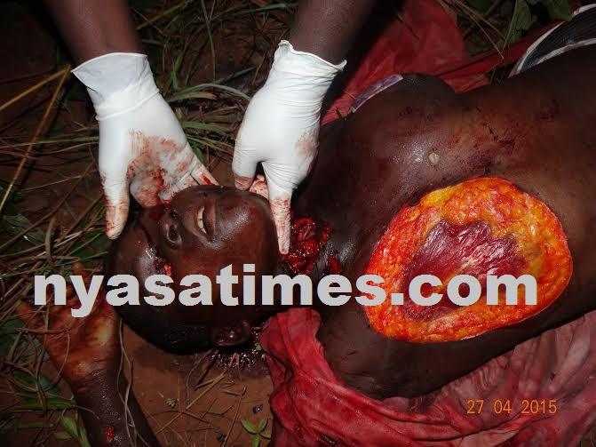 Girl brutaly murdered in Mchinji