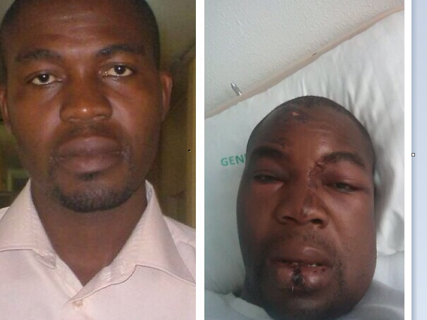 Maurice Chikapa (Left) as he was ok and then beaten on right)