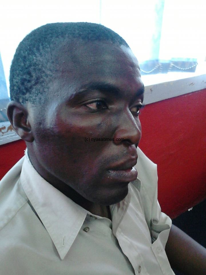 Kasakura: Victim of Malaiw police brutality