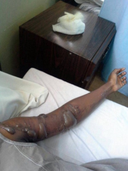 The man who has been in critical condition has died
