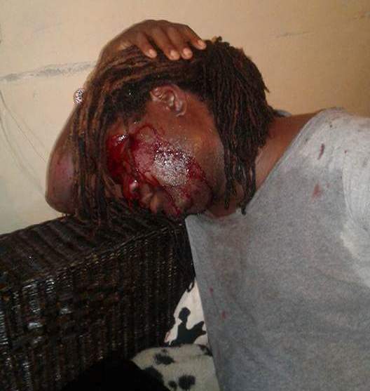 Gay attack in Lilongwe