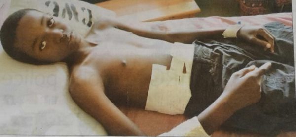 Humphreys Jere Junior currently battling for his life at Kamuzu Central Hospital