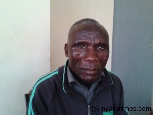 Owen Banda: Arrested for protecting his land