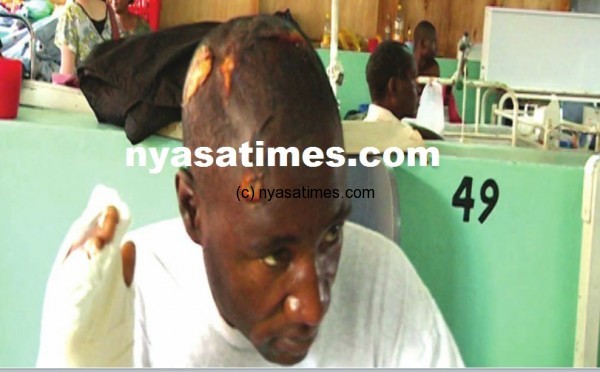 Mtuwa at the hospital receiving treatment after being hacked