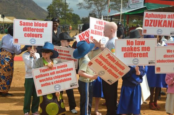 Displays by people with albinism