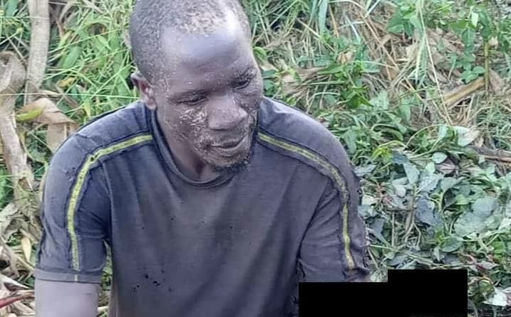 Wages of sin: Escom vandal dies due to burns after electrocution - Vimarsana News