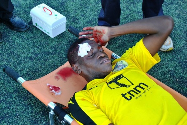 Tigers defender in pain....Photo Jeromy Kadewere