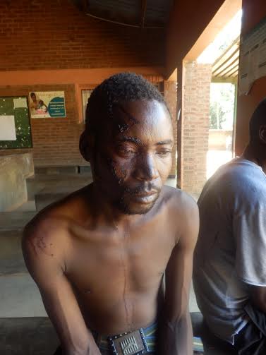 A patient who is losing blood is waiting for a ealth worker from lunch to assist him